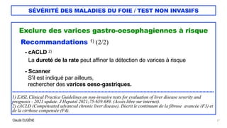 Claude EUGÈNE
SÉVÉRITÉ DES MALADIES DU FOIE / TEST NON INVASIFS
Exclure des varices gastro-oesophagiennes à risque


Recom...