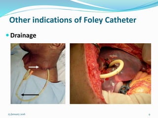 Other indications of Foley Catheter
 Drainage
23 January 2016 9
 