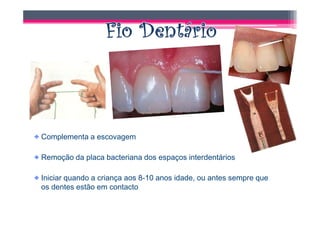 Complementa a escovagem

Remoção da placa bacteriana dos espaços interdentários

Iniciar quando a criança aos 8-10 anos idade, ou antes sempre que
os dentes estão em contacto
 