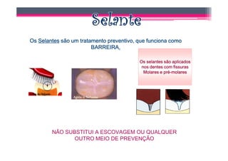 Os Selantes são um tratamento preventivo, que funciona como
                        BARREIRA.
                        BARREIRA.

                                          Os selantes são aplicados
                                           nos dentes com fissuras
                                            Molares e pré-molares
                                                      pré-




        NÃO SUBSTITUI A ESCOVAGEM OU QUALQUER
               OUTRO MEIO DE PREVENÇÃO
 
