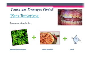 Placa Bacteriana:
Forma-se através de:




Bactérias/ microorganismos   Restos alimentares   saliva
 