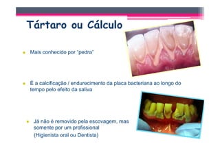 Mais conhecido por “pedra”




É a calcificação / endurecimento da placa bacteriana ao longo do
tempo pelo efeito da saliva




 Já não é removido pela escovagem, mas
 somente por um profissional
 (Higienista oral ou Dentista)
 