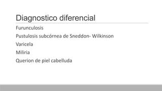 Diagnostico diferencial
Furunculosis
Pustulosis subcórnea de Sneddon- Wilkinson
Varicela
Miliria
Querion de piel cabelluda
