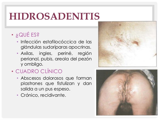 La medicina la corrección del pecho