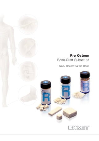 Pro Osteon
Bone Graft Substitute
Track Record1
to the Bone
 