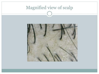 Magnified view of scalp
 