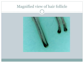 Magnified view of hair follicle
 