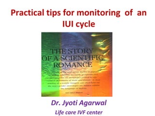 Practical tips for monitoring of an
IUI cycle
Dr. Jyoti Agarwal
Life care IVF center
 