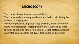 MICROSCOPY
• The tumor shows fibrous encapsulation.
• The tumor cells are benign follicular epithelial cells lining the
follicles of varying size.
• Variety of patterns of growth may be seen, most commonly
being microfollicular (foetal) pattern characterized by small
follicles containing little or no colloid. Other patterns include
macrofollicular, hurthle cell type, trabecular and atypical.
 