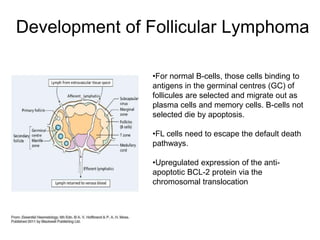 Development of Follicular Lymphoma
•For normal B-cells, those cells binding to
antigens in the germinal centres (GC) of
follicules are selected and migrate out as
plasma cells and memory cells. B-cells not
selected die by apoptosis.
•FL cells need to escape the default death
pathways.
•Upregulated expression of the anti-
apoptotic BCL-2 protein via the
chromosomal translocation
 