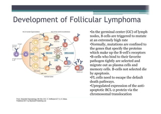 Development of Follicular Lymphoma
•In the germinal center (GC) of lymph
nodes, B cells are triggered to mutate
at an extremely high rate
•Normally, mutations are confined to
the genes that specify the proteins
which make up the B-cell’s receptors
•B-cells who bind to their favorite
pathogen tightly are selected and
migrate out as plasma cells and
memory cells. B-cells not selected die
by apoptosis.
•FL cells need to escape the default
death pathways.
•Upregulated expression of the anti-
apoptotic BCL-2 protein via the
chromosomal translocation
 