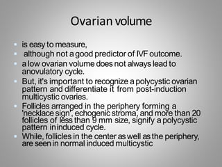 Ovarianvolume
 is easy to measure,
 although not agood predictor of IVFoutcome.
 alow ovarian volume does not always lead to
anovulatory cycle.
 But, it's important to recognize apolycystic ovarian
pattern and differentiate it from post-induction
multicystic ovaries.
 Follicles arranged in the periphery forming a
'necklacesign', echogenic stroma, and more than 20
follicles of less than 9 mm size, signify apolycystic
pattern ininduced cycle.
 While, follicles in the center aswell asthe periphery,
are seenin normal induced multicystic
 