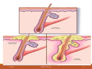3/2/2020 @NOBLE AJUNA 2020. 9
 