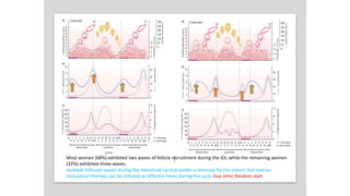 Most women (68%) exhibited two waves of follicle recruitment during the IOI, while the remaining women
(32%) exhibited three waves.
multiple follicular waves during the menstrual cycle provides a rationale for the notion that ovarian
stimulation therapy can be initiated at different times during the cycle-Duo stim/ Random start
 