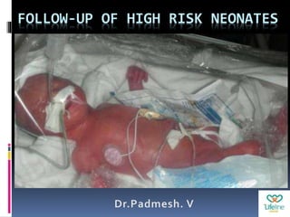 FOLLOW-UP OF HIGH RISK NEONATES
 