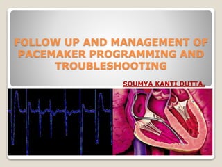 FOLLOW UP AND MANAGEMENT OF
PACEMAKER PROGRAMMING AND
TROUBLESHOOTING
SOUMYA KANTI DUTTA.
 