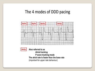 Follow up and management of pacemaker programming and | PPTX