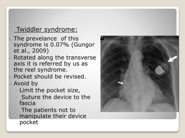 Follow up and management of pacemaker programming and | PPTX