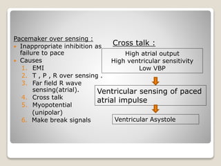 Oversensitive Pacemaker Follow up and management of pacemaker programming and | PPTX
