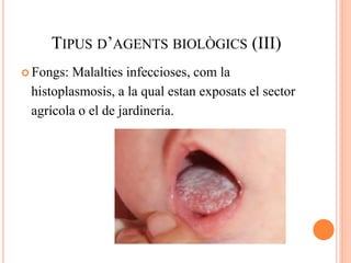 TIPUS D’AGENTS BIOLÒGICS (III)
 Fongs: Malalties infeccioses, com la
histoplasmosis, a la qual estan exposats el sector
agrícola o el de jardineria.
 