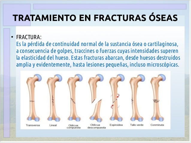 Tratamiento en fracturas óseas