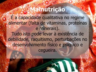 Malnutrição   É a capacidade qualitativa no regime alimentar (falta de vitaminas, proteínas e minerais). Tudo isto pode levar à existência de debilidade, raquitismo, perturbações no desenvolvimento físico e psíquico e cegueira. 