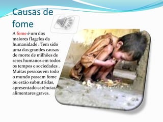 Causas de
fome
A fome é um dos
maiores flagelos da
humanidade . Tem sido
uma das grandes causas
de morte de milhões de
seres humanos em todos
os tempos e sociedades .
Muitas pessoas em todo
o mundo passam fome
ou estão subnutridas,
apresentado carências
alimentares graves.
 