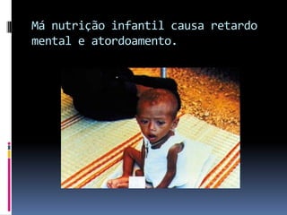 Má nutrição infantil causa retardo mental e atordoamento. 