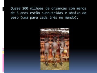 Quase 200 milhões de crianças com menos de 5 anos estão subnutridas e abaixo do peso (uma para cada três no mundo); 