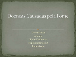 Desnutrição
Anemia
Bócio Endêmico
Hipovitaminose A
Raquitismo
 