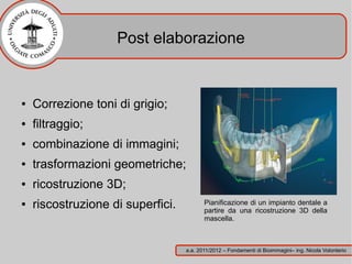 Post elaborazione


●   Correzione toni di grigio;
●   filtraggio;
●   combinazione di immagini;
●   trasformazioni geometriche;
●   ricostruzione 3D;
●   riscostruzione di superfici.          Pianificazione di un impianto dentale a
                                          partire da una ricostruzione 3D della
                                          mascella.



                                   a.a. 2011/2012 – Fondamenti di Bioimmagini– ing. Nicola Volonterio
 