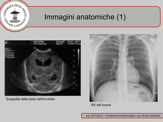 Immagini anatomiche (1)




Ecografia della base dell'encefalo
                                         RX del torace


                                     a.a. 2011/2012 – Fondamenti di Bioimmagini– ing. Nicola Volonterio
 