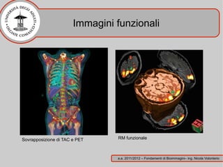 Immagini funzionali




Sovrapposizione di TAC e PET    RM funzionale



                                a.a. 2011/2012 – Fondamenti di Bioimmagini– ing. Nicola Volonterio
 