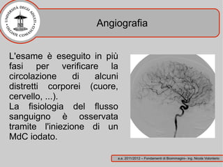Angiografia


L'esame è eseguito in più
fasi per verificare la
circolazione     di alcuni
distretti corporei (cuore,
cervello, ...).
La fisiologia del flusso
sanguigno è osservata
tramite l'iniezione di un
MdC iodato.

                         a.a. 2011/2012 – Fondamenti di Bioimmagini– ing. Nicola Volonterio
 