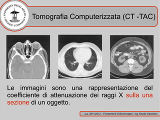 Tomografia Computerizzata (CT -TAC)




Le immagini sono una rappresentazione del
coefficiente di attenuazione dei raggi X sulla una
sezione di un oggetto.
                          a.a. 2011/2012 – Fondamenti di Bioimmagini– ing. Nicola Volonterio
 