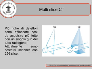 Multi slice CT



Più righe di detettori
sono affiancate così
da acquisire più fette
con un singolo giro del
tubo radiogeno.
Attualmente       sono
costruiti scanner con
256 slice.


                               a.a. 2011/2012 – Fondamenti di Bioimmagini– ing. Nicola Volonterio
 