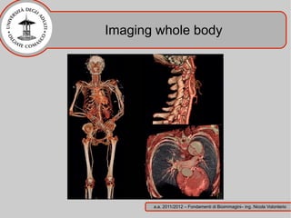 Imaging whole body




       a.a. 2011/2012 – Fondamenti di Bioimmagini– ing. Nicola Volonterio
 