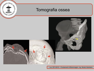 Tomografia ossea




      a.a. 2011/2012 – Fondamenti di Bioimmagini– ing. Nicola Volonterio
 