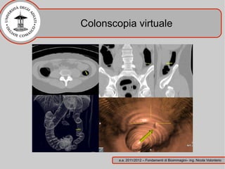 Colonscopia virtuale




        a.a. 2011/2012 – Fondamenti di Bioimmagini– ing. Nicola Volonterio
 