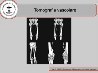 Tomografia vascolare




        a.a. 2011/2012 – Fondamenti di Bioimmagini– ing. Nicola Volonterio
 