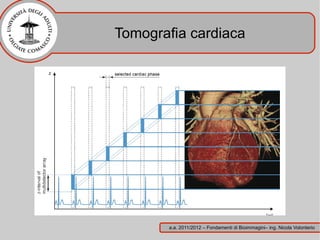 Tomografia cardiaca




       a.a. 2011/2012 – Fondamenti di Bioimmagini– ing. Nicola Volonterio
 