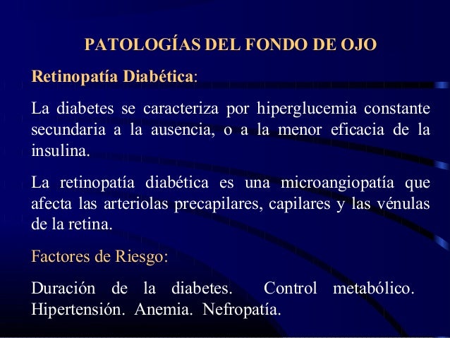 Fondo de ojo Fondo de ojo