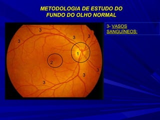METODOLOGIA DDEE EESSTTUUDDOO DDOO 
FFUUNNDDOO DDOO OOLLHHOO NNOORRMMAALL 
1 
2 
3 
3 
3 
3 
3 
3 
3 
33-- VVAASSOOSS 
SSAANNGGUUÍÍNNEEOOSS:: 
 