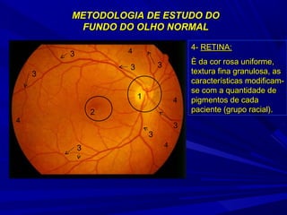 METODOLOGIA DDEE EESSTTUUDDOO DDOO 
FFUUNNDDOO DDOO OOLLHHOO NNOORRMMAALL 
1 
2 
3 
3 
3 
3 
3 
3 
3 
4 
4 
4 
4 
44-- RREETTIINNAA:: 
ÈÈ ddaa ccoorr rroossaa uunniiffoorrmmee,, 
tteexxttuurraa ffiinnaa ggrraannuulloossaa,, aass 
ccaarraacctteerrííssttiiccaass mmooddiiffiiccaamm-- 
ssee ccoomm aa qquuaannttiiddaaddee ddee 
ppiiggmmeennttooss ddee ccaaddaa 
ppaacciieennttee ((ggrruuppoo rraacciiaall)).. 
 