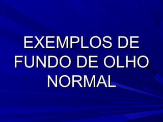 EEXXEEMMPPLLOOSS DDEE 
FFUUNNDDOO DDEE OOLLHHOO 
NNOORRMMAALL 
 