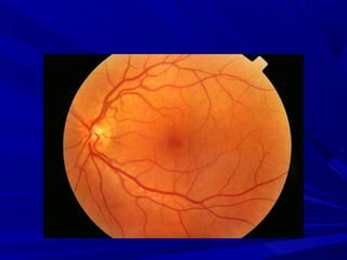 FUNDOSCOPIA. METODO DE ESTUDO