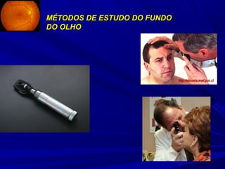 MÉTODOS DDEE EESSTTUUDDOO DDOO FFUUNNDDOO 
DDOO OOLLHHOO 
 