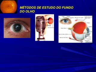 MÉTODOS DDEE EESSTTUUDDOO DDOO FFUUNNDDOO 
DDOO OOLLHHOO 
 