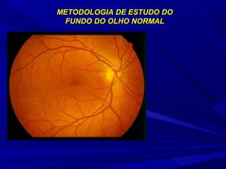 METODOLOGIA DDEE EESSTTUUDDOO DDOO 
FFUUNNDDOO DDOO OOLLHHOO NNOORRMMAALL 
 