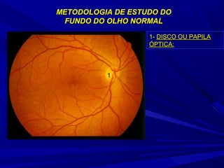 METODOLOGIA DDEE EESSTTUUDDOO DDOO 
FFUUNNDDOO DDOO OOLLHHOO NNOORRMMAALL 
1 
11-- DDIISSCCOO OOUU PPAAPPIILLAA 
ÓÓPPTTIICCAA:: 
 